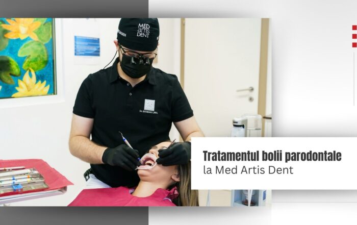 Dr Bogdan Linul tratament parodontal Med Artis Dent