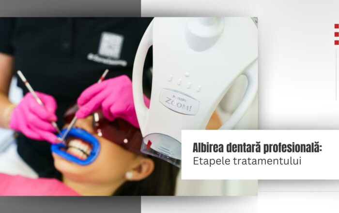 Albire dentara cu lampa Philips Zoom in clinica Med Artis Dent, Cluj Napoca