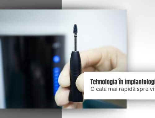 Tehnologia în implantologie, o cale mai rapidă spre vindecare