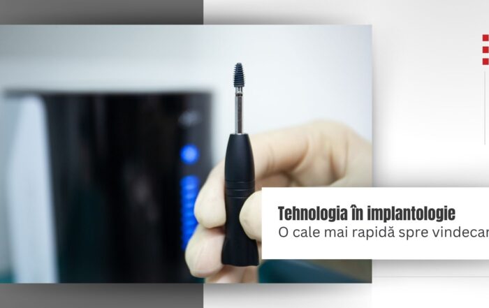 Implant Plasma X Med Artis Dent