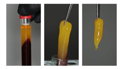 Fibrină bogată în trombocite, Platelet Rich Fibrin, PRF