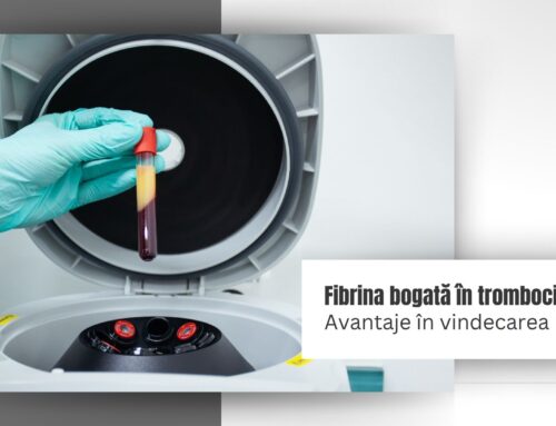 Avantajele tehnologiei PRF în vindecarea plăgilor chirurgicale