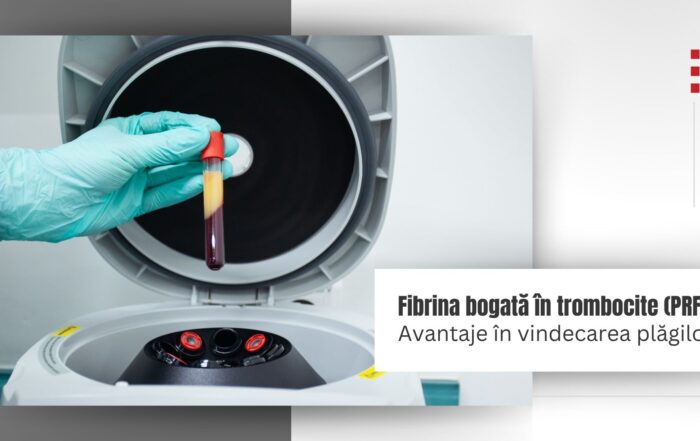 PRF, fibrină bogată în trombocite, Platelet Rich Fibrin