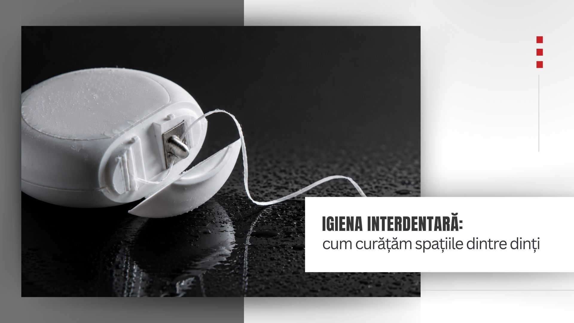 Igiena interdentara la clinica Med Artis Dent